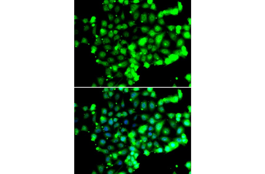 Immunofluorescence - Anti-FASTK Antibody (A7069) - Antibodies.com