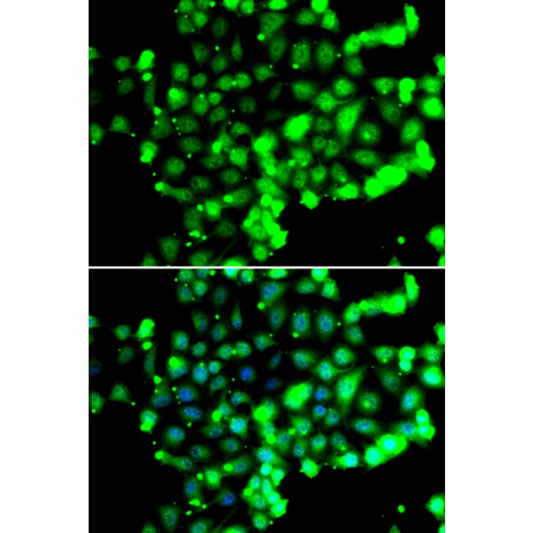 Immunofluorescence - Anti-FASTK Antibody (A7069) - Antibodies.com