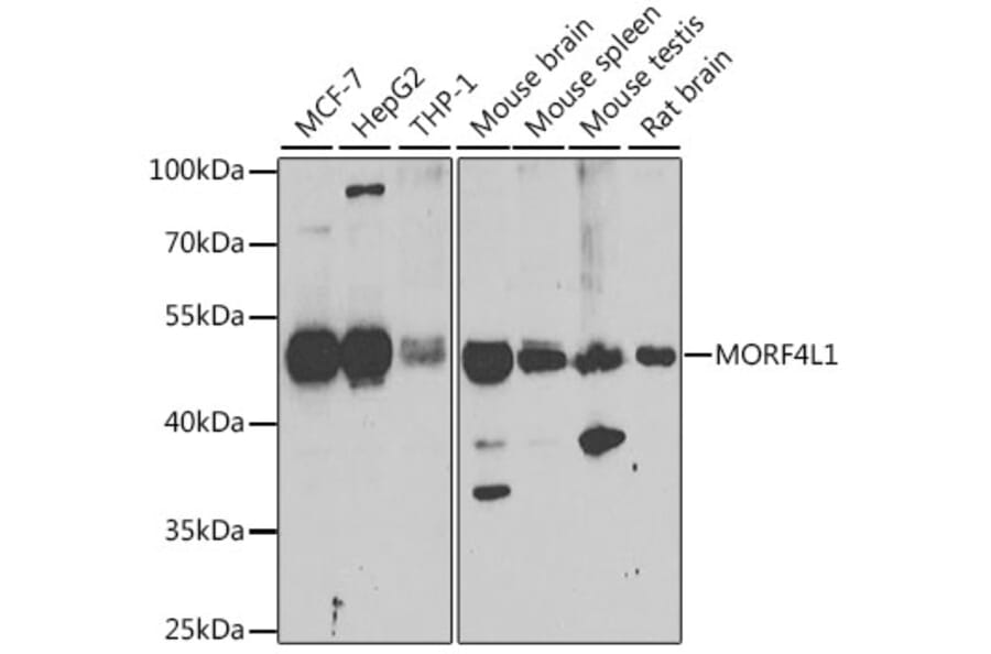 Western Blot - Anti-MRG15 Antibody (A15522) - Antibodies.com