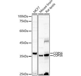 Western Blot - Anti-COPS6 Antibody (A15523) - Antibodies.com