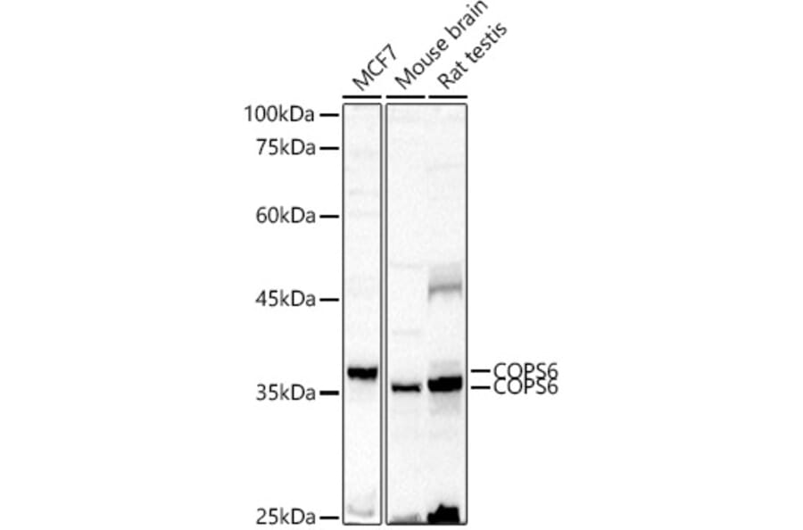 Western Blot - Anti-COPS6 Antibody (A15523) - Antibodies.com