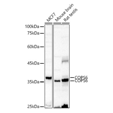 Western Blot - Anti-COPS6 Antibody (A15523) - Antibodies.com