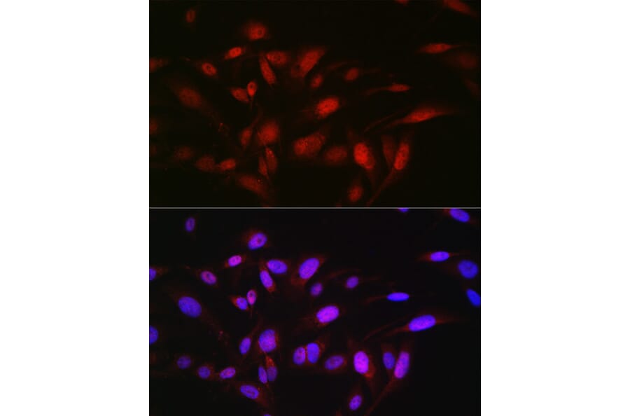 Immunofluorescence - Anti-OGFr Antibody (A15524) - Antibodies.com