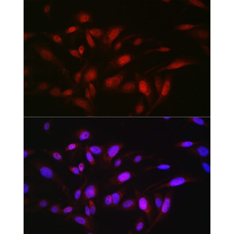 Immunofluorescence - Anti-OGFr Antibody (A15524) - Antibodies.com