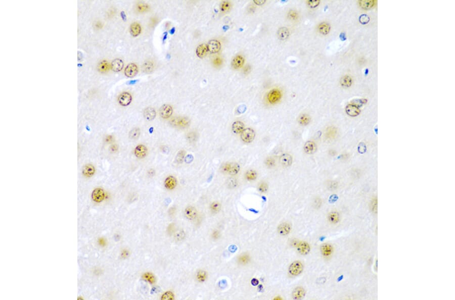 Immunohistochemistry - Anti-TUSC2/FUS1 Antibody (A15525) - Antibodies.com