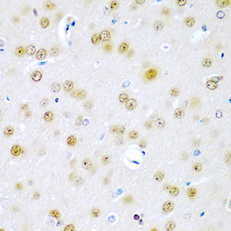 Immunohistochemistry - Anti-TUSC2/FUS1 Antibody (A15525) - Antibodies.com
