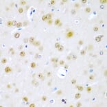 Immunohistochemistry - Anti-TUSC2/FUS1 Antibody (A15525) - Antibodies.com
