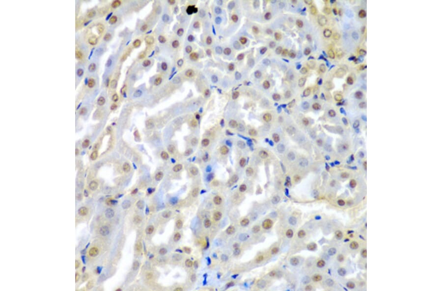 Immunohistochemistry - Anti-TUSC2/FUS1 Antibody (A15525) - Antibodies.com