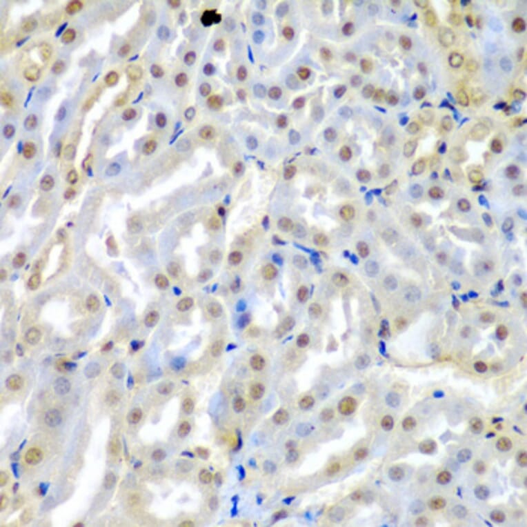 Immunohistochemistry - Anti-TUSC2/FUS1 Antibody (A15525) - Antibodies.com