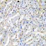 Immunohistochemistry - Anti-TUSC2/FUS1 Antibody (A15525) - Antibodies.com