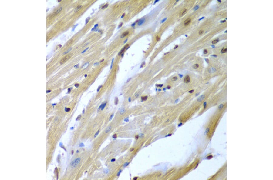 Immunohistochemistry - Anti-TUSC2/FUS1 Antibody (A15525) - Antibodies.com