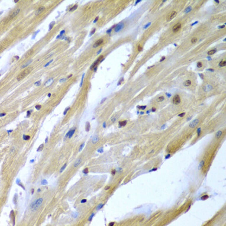 Immunohistochemistry - Anti-TUSC2/FUS1 Antibody (A15525) - Antibodies.com