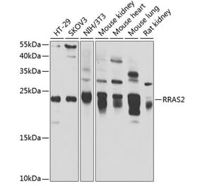 Western Blot - Anti-TC21 Antibody (A15526) - Antibodies.com