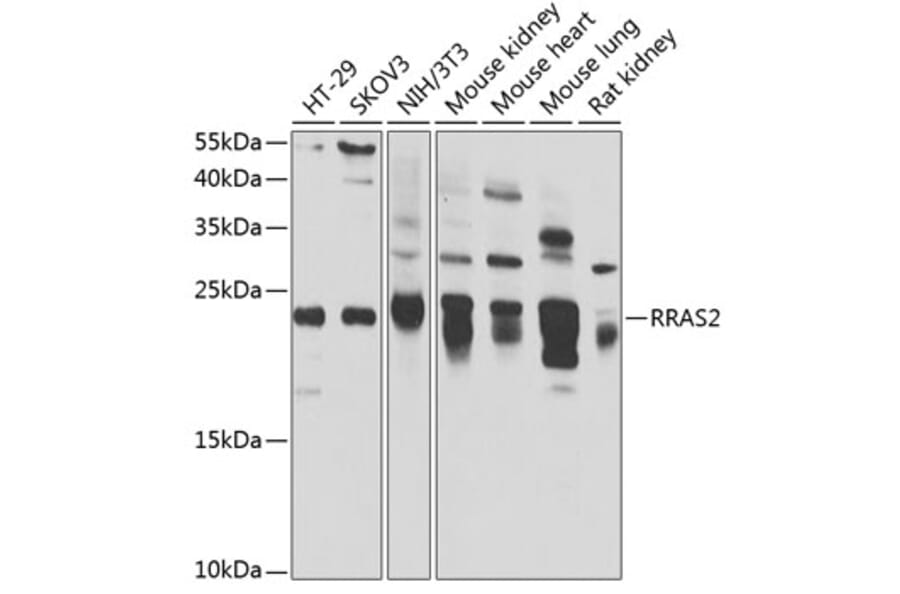 Western Blot - Anti-TC21 Antibody (A15526) - Antibodies.com