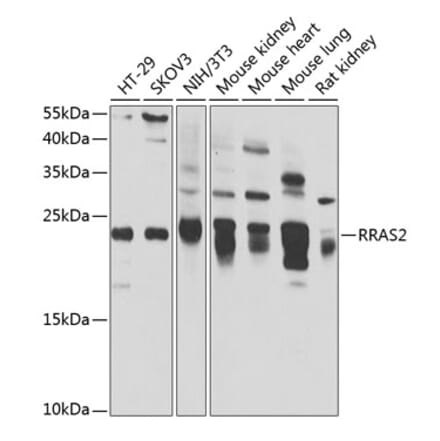 Western Blot - Anti-TC21 Antibody (A15526) - Antibodies.com
