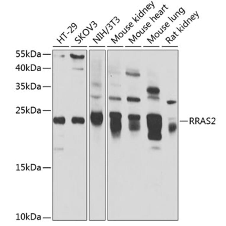 Western Blot - Anti-TC21 Antibody (A15526) - Antibodies.com