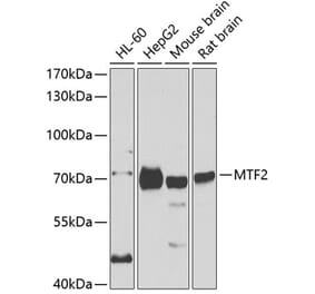 Western Blot - Anti-MTF2 Antibody (A15527) - Antibodies.com