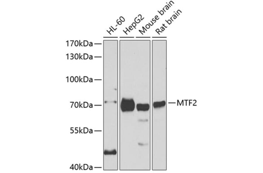 Western Blot - Anti-MTF2 Antibody (A15527) - Antibodies.com