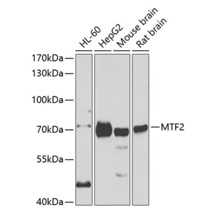 Western Blot - Anti-MTF2 Antibody (A15527) - Antibodies.com