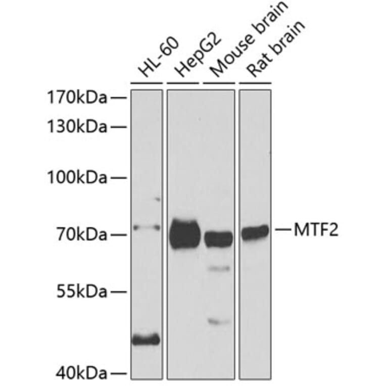 Western Blot - Anti-MTF2 Antibody (A15527) - Antibodies.com