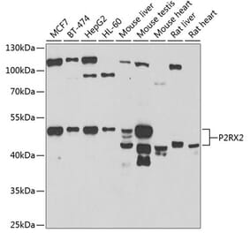 Western Blot - Anti-P2X2 Antibody (A15528) - Antibodies.com