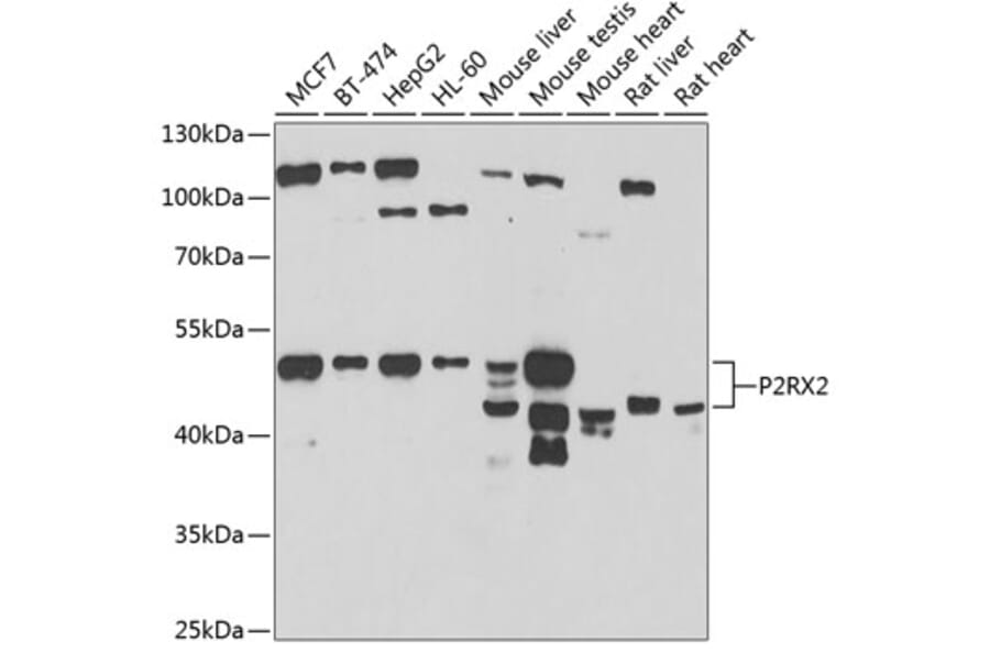 Western Blot - Anti-P2X2 Antibody (A15528) - Antibodies.com