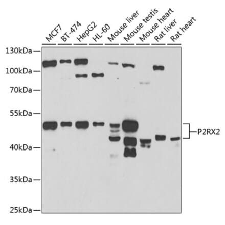 Western Blot - Anti-P2X2 Antibody (A15528) - Antibodies.com