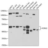 Western Blot - Anti-P2X2 Antibody (A15528) - Antibodies.com