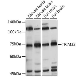 Western Blot - Anti-TRIM32 Antibody (A15529) - Antibodies.com
