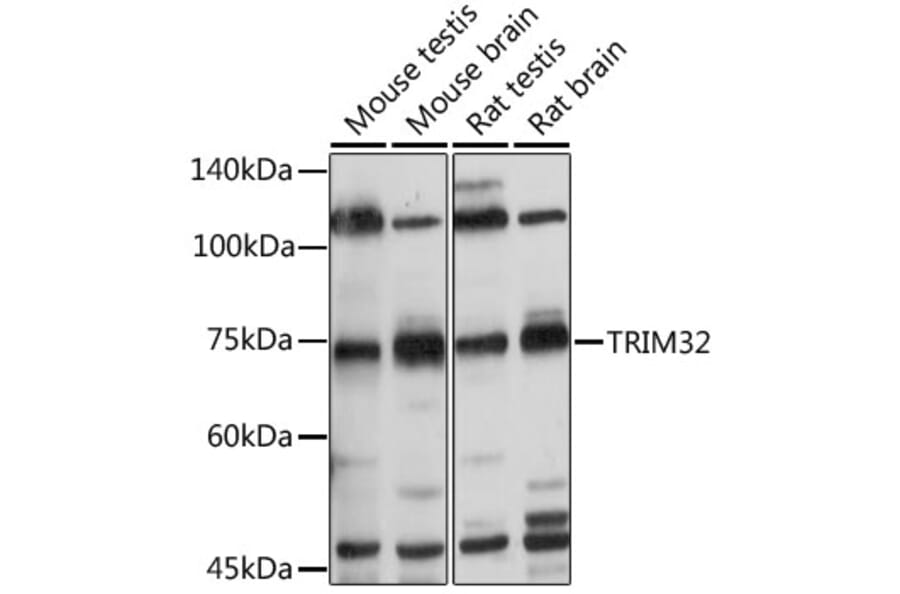 Western Blot - Anti-TRIM32 Antibody (A15529) - Antibodies.com