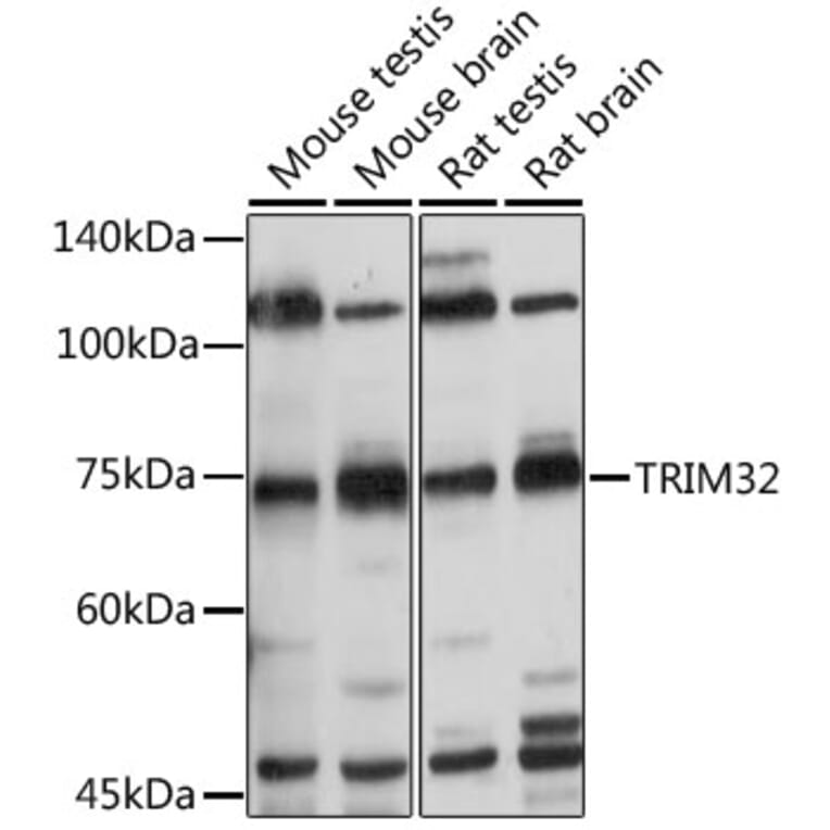 Western Blot - Anti-TRIM32 Antibody (A15529) - Antibodies.com