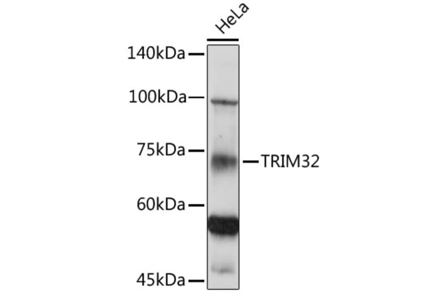 Western Blot - Anti-TRIM32 Antibody (A15529) - Antibodies.com