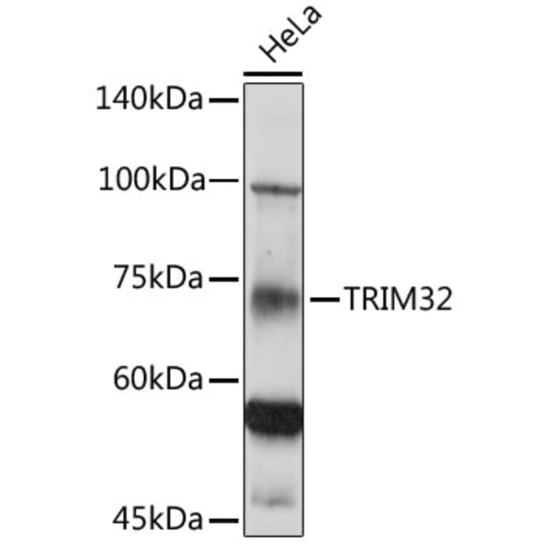 Western Blot - Anti-TRIM32 Antibody (A15529) - Antibodies.com