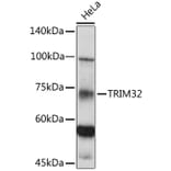 Western Blot - Anti-TRIM32 Antibody (A15529) - Antibodies.com