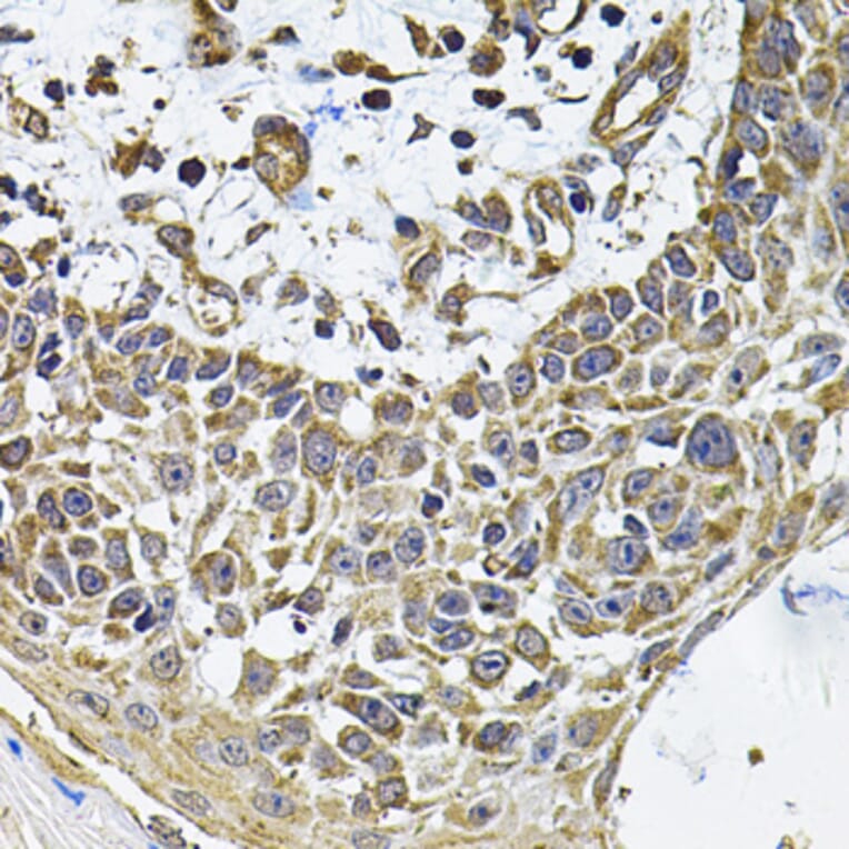 Immunohistochemistry - Anti-ICOS Ligand/ICOSL Antibody (A15530) - Antibodies.com