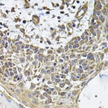 Immunohistochemistry - Anti-ICOS Ligand/ICOSL Antibody (A15530) - Antibodies.com