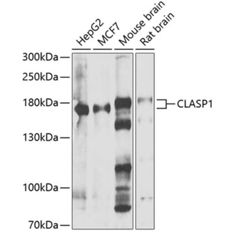 Western Blot - Anti-CLASP1 Antibody (A15531) - Antibodies.com