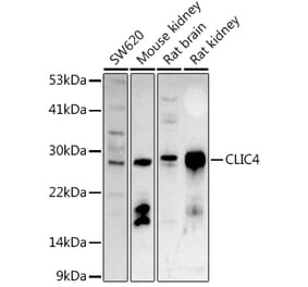 Western Blot - Anti-CLIC4 Antibody (A15535) - Antibodies.com