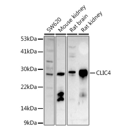 Western Blot - Anti-CLIC4 Antibody (A15535) - Antibodies.com