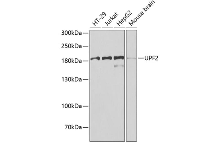 Western Blot - Anti-hUPF2/RENT2 Antibody (A15536) - Antibodies.com