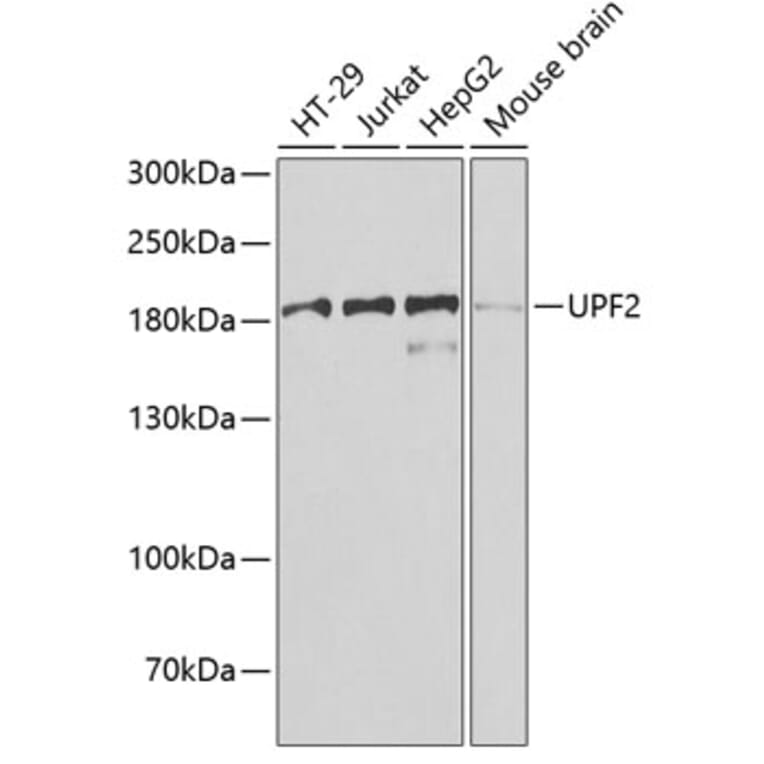 Western Blot - Anti-hUPF2/RENT2 Antibody (A15536) - Antibodies.com