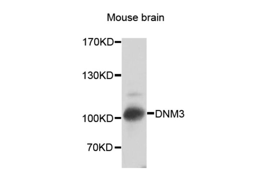 Western Blot - Anti-DNM3 Antibody (A7092) - Antibodies.com