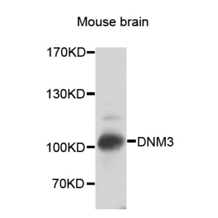 Western Blot - Anti-DNM3 Antibody (A7092) - Antibodies.com