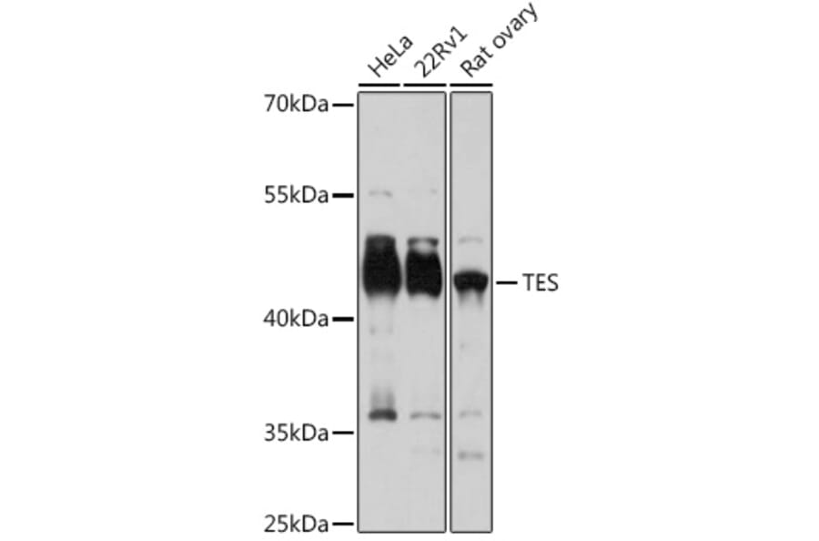 Western Blot - Anti-Testin Antibody (A15538) - Antibodies.com