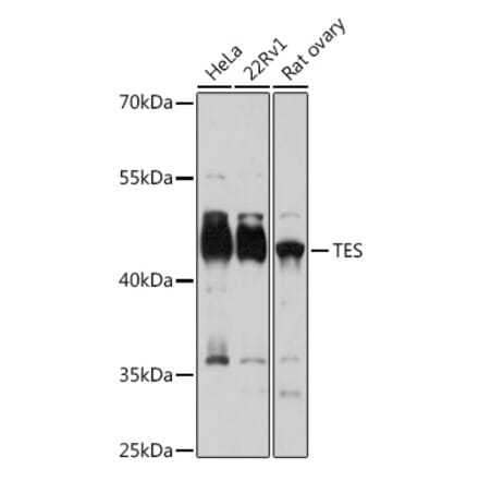 Western Blot - Anti-Testin Antibody (A15538) - Antibodies.com