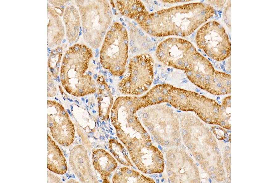 Immunohistochemistry - Anti-Testin Antibody (A15538) - Antibodies.com