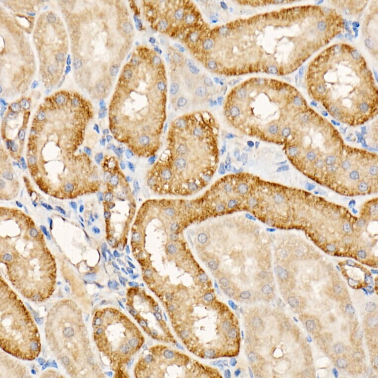 Immunohistochemistry - Anti-Testin Antibody (A15538) - Antibodies.com