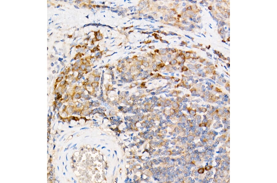 Immunohistochemistry - Anti-Testin Antibody (A15538) - Antibodies.com