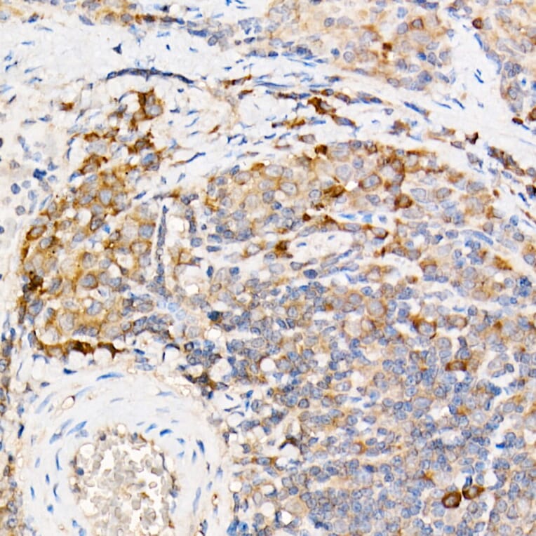 Immunohistochemistry - Anti-Testin Antibody (A15538) - Antibodies.com