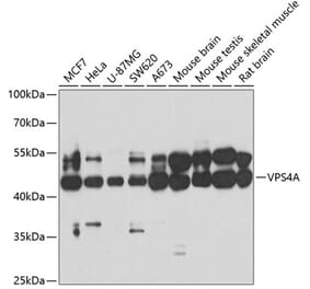 Western Blot - Anti-VPS4a Antibody (A15539) - Antibodies.com